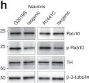 Tyrosine Hydroxylase Antibody