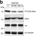 Tyrosine Hydroxylase Antibody