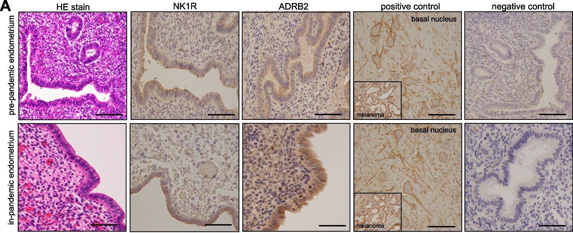 NK1R Antibody - BSA Free