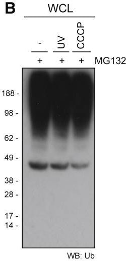 Ubiquitin Antibody (Ubi-1)