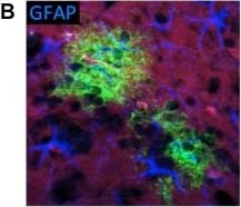 GFAP Antibody