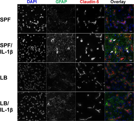 GFAP Antibody