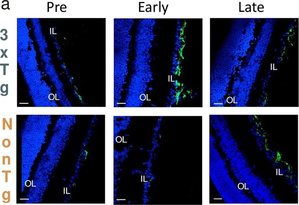 GFAP Antibody