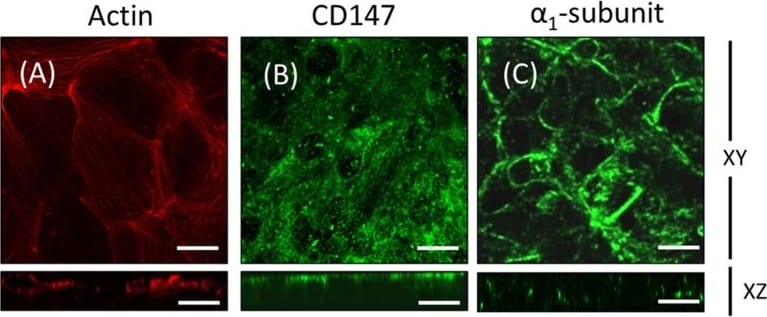 Sodium Potassium ATPase Alpha 1 Antibody (464.6)