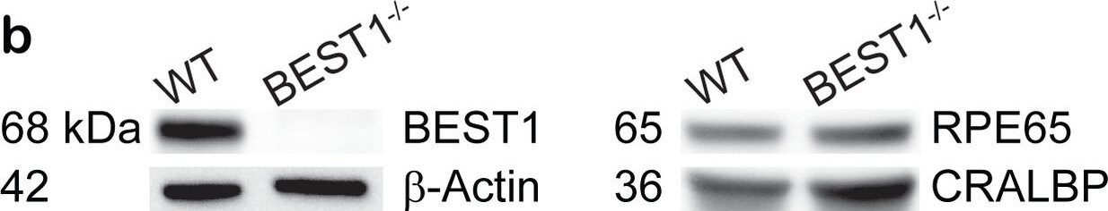 Bestrophin 1 Antibody (E6-6) - BSA Free