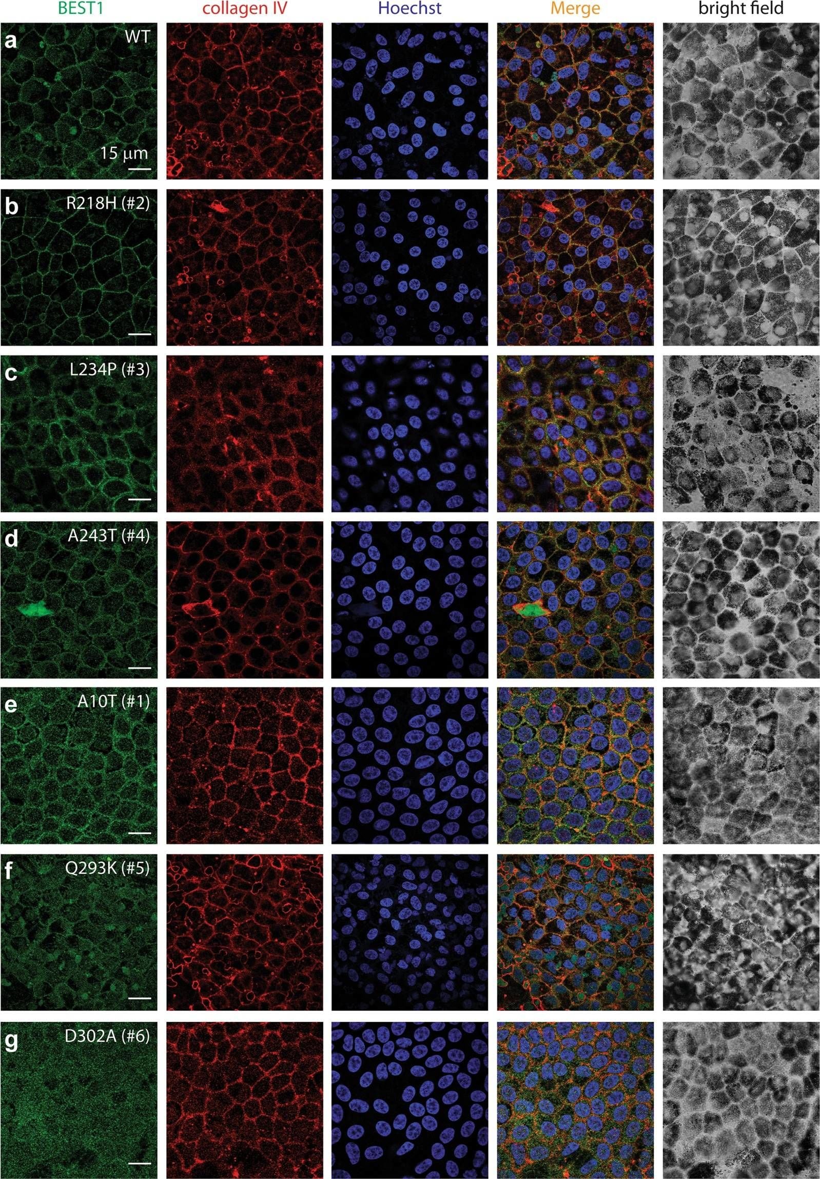 Bestrophin 1 Antibody (E6-6) - BSA Free