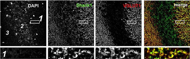 SHANK1 Antibody - BSA Free