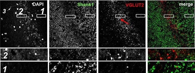 SHANK1 Antibody - BSA Free
