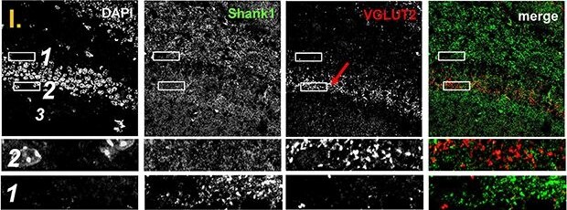 SHANK1 Antibody - BSA Free