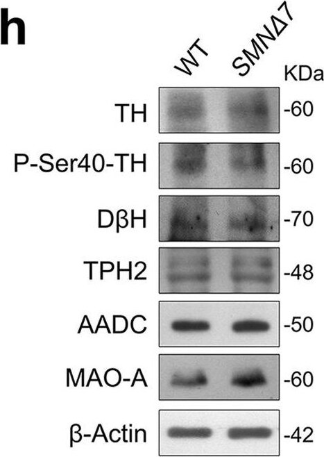 Dopa Decarboxylase/DDC Antibody - Azide Free