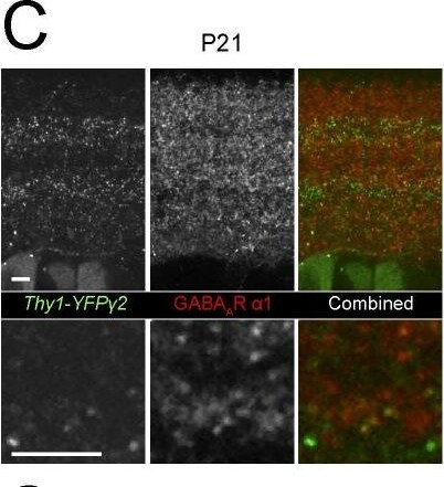 GABA-A R gamma 2 Antibody