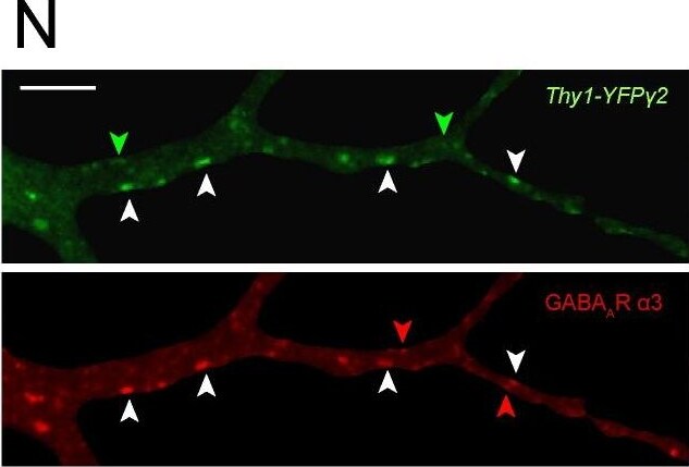 GABA-A R gamma 2 Antibody