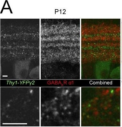 GABA-A R gamma 2 Antibody
