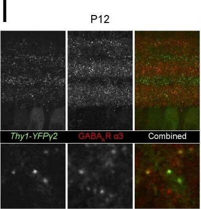 GABA-A R gamma 2 Antibody
