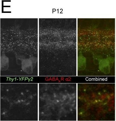 GABA-A R gamma 2 Antibody