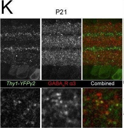 GABA-A R gamma 2 Antibody