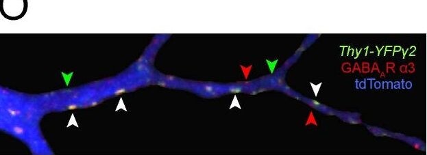 GABA-A R gamma 2 Antibody