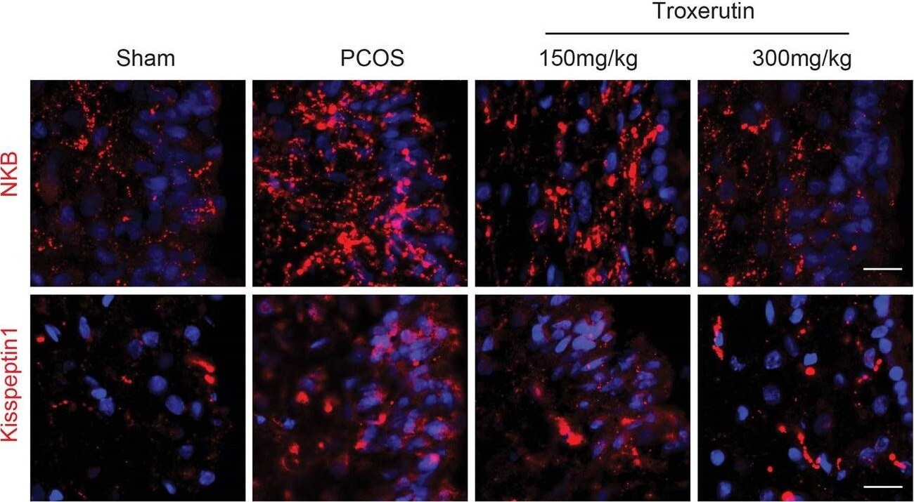 Neurokinin B Antibody - BSA Free