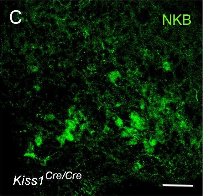 Neurokinin B Antibody - BSA Free