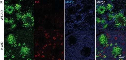 MAP2 Antibody