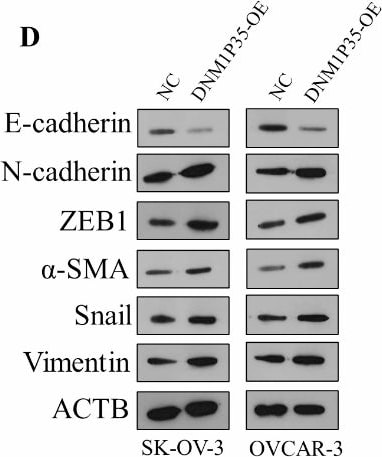 Vimentin Antibody