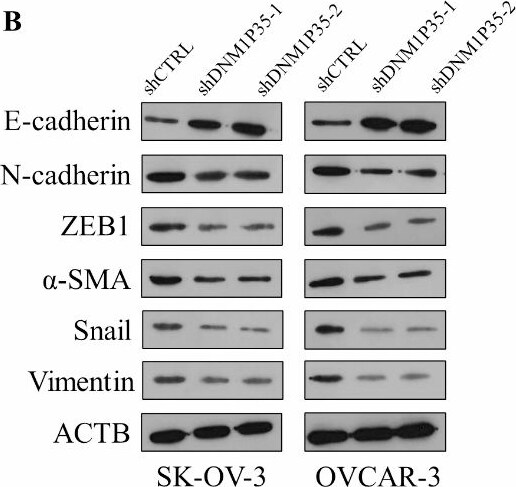 Vimentin Antibody