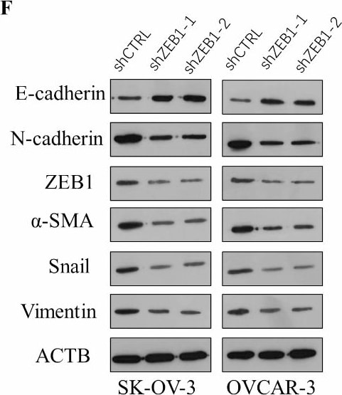 Vimentin Antibody