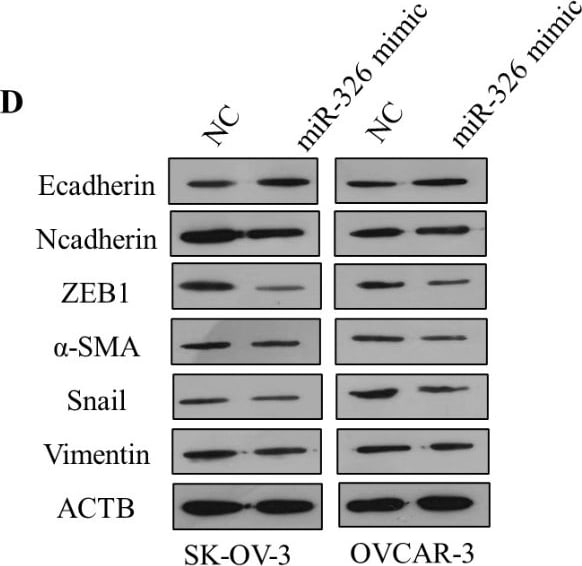 Vimentin Antibody