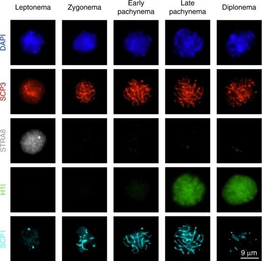 SCP1 Antibody [Biotin]