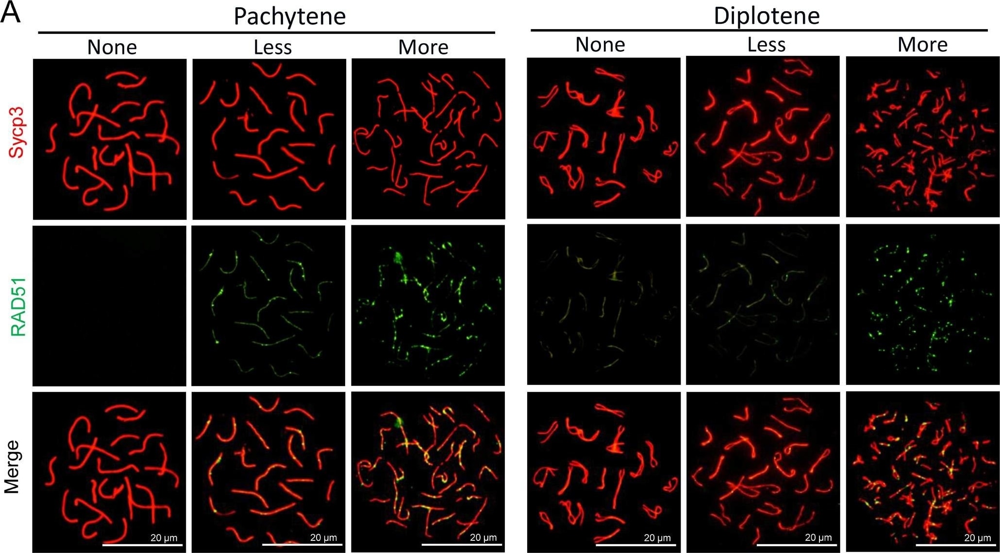 SCP3/SYCP3 Antibody - BSA Free