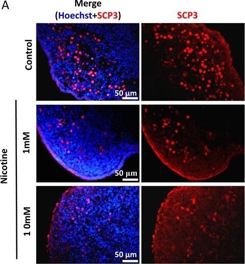 SCP3/SYCP3 Antibody - BSA Free