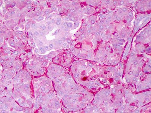 Notch-1 Antibody - (Cleaved N terminal)