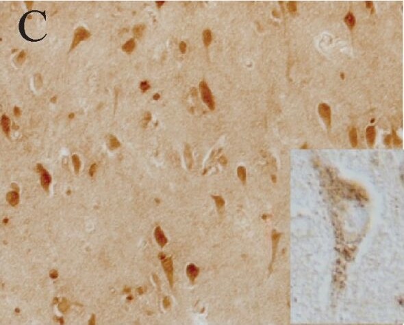 LRRK2 Antibody - BSA Free