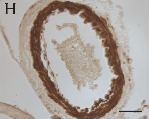 LRRK2 Antibody - BSA Free