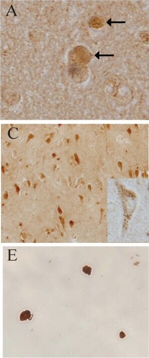 LRRK2 Antibody - BSA Free
