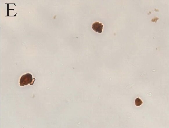 LRRK2 Antibody - BSA Free