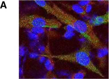 LRRK2 Antibody - BSA Free