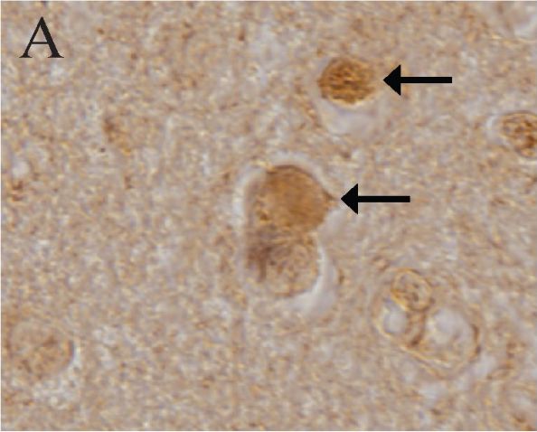 LRRK2 Antibody - BSA Free