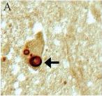 LRRK2 Antibody - BSA Free