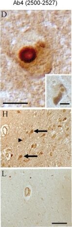 LRRK2 Antibody - BSA Free