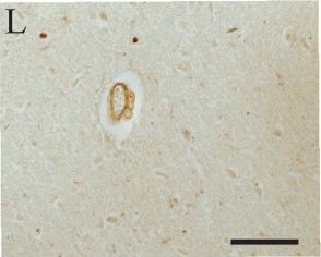 LRRK2 Antibody - BSA Free