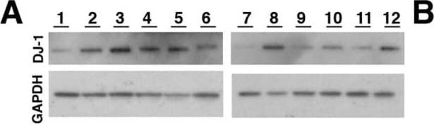 Park7/DJ-1 Antibody