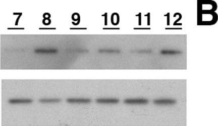 Park7/DJ-1 Antibody