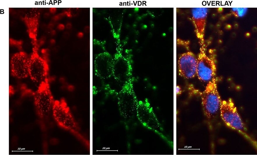 APP Antibody