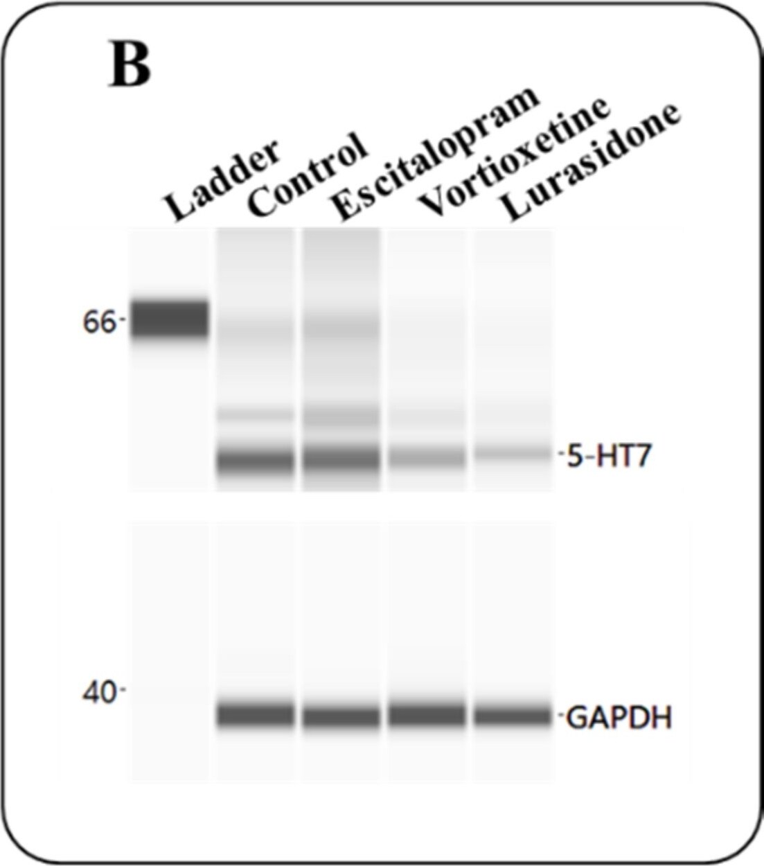 GAPDH Antibody