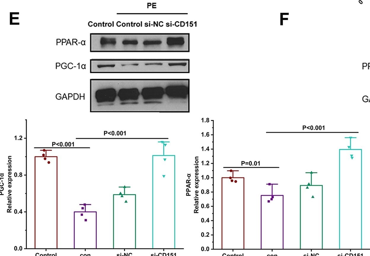 PPAR alpha/NR1C1 Antibody (3B6/PPAR) - BSA Free