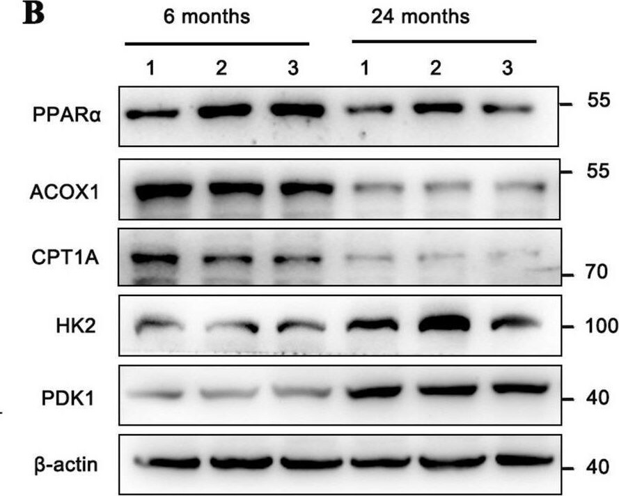 PPAR alpha/NR1C1 Antibody (3B6/PPAR) - BSA Free