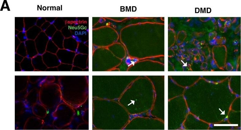 Spectrin beta 1 Antibody (4C3)