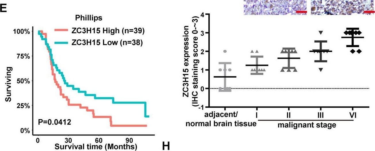 ZC3H15 Antibody - BSA Free