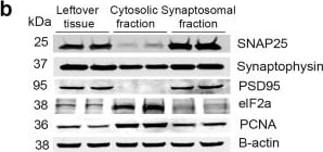 Synaptophysin Antibody